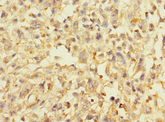 AVPI1 Antibody