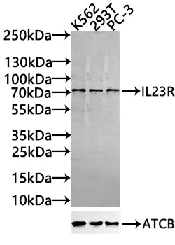 IL23R Antibody