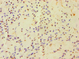 HAUS3 Antibody