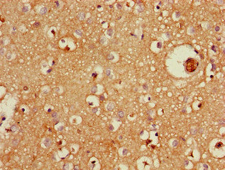 ZFYVE26 Antibody