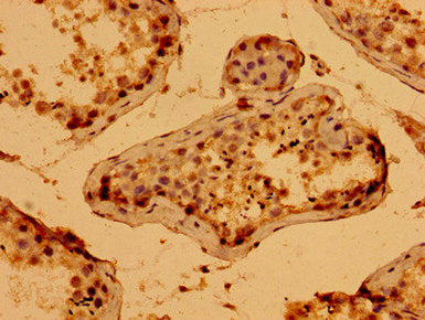 WWC2 Antibody