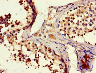 FAM102B Antibody