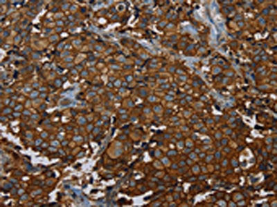 ERBB4 Antibody