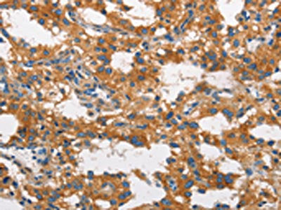 CLTC Antibody