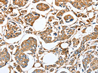 CAPG Antibody