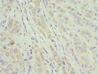CIAPIN1 Antibody