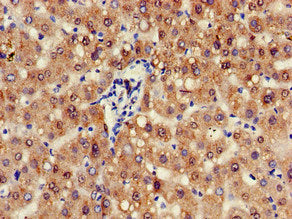 ZFAND6 Antibody