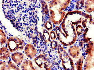 RPL22L1 Antibody