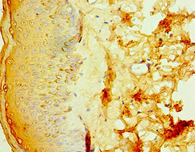 IL20RB Antibody