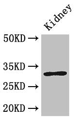 FAM151B Antibody