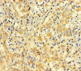 ARHGAP27 Antibody