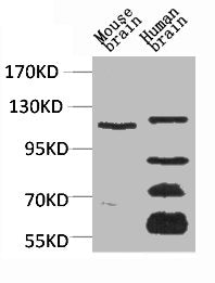 CACNA2D3 Antibody