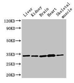 AHSA2P Antibody