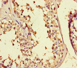 MED25 Antibody