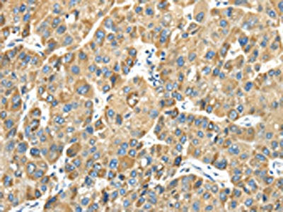 TMPRSS11E Antibody