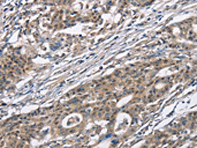 CACNA1D Antibody