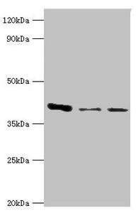 RRM2B Antibody