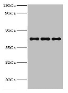 RRM2B Antibody