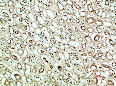 PLK2 Antibody
