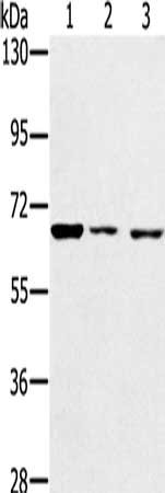 IGF2BP3 Antibody