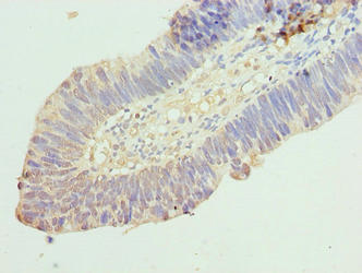 RINT1 Antibody