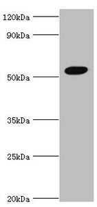 AEBP2 Antibody