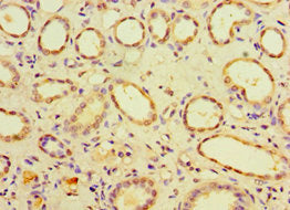 CHMP1B Antibody