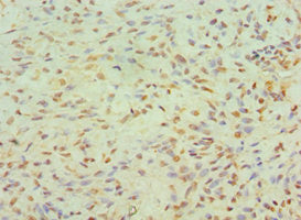 JMJD6 Antibody