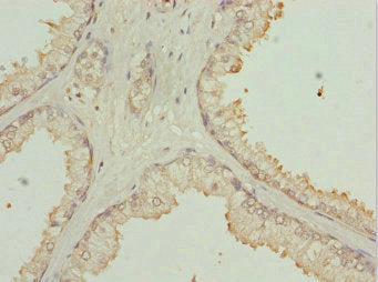 ULK3 Antibody