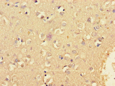 KCNIP4 Antibody
