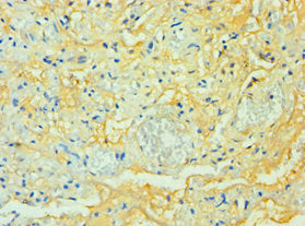 TTBK2 Antibody