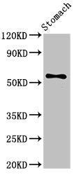 SMARCD3 Antibody