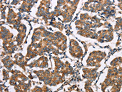 ELP3 Antibody