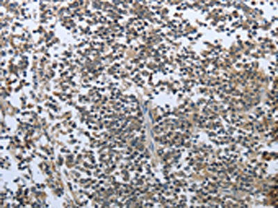 PRL Antibody