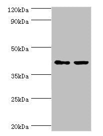GTF2H2C Antibody