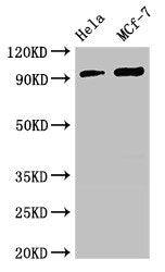 TTC27 Antibody
