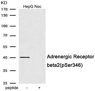 Phospho-ADRB2 (Ser346) Antibody