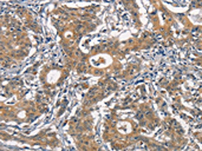 CR2 Antibody