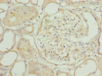 EPM2AIP1 Antibody