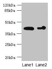 ASPHD2 Antibody