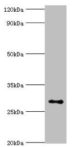 ALKBH2 Antibody