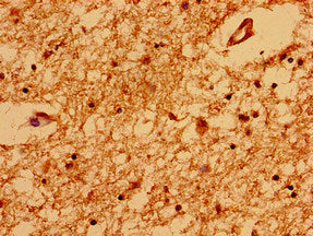 TRNP1 Antibody