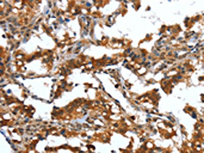 DEFA4 Antibody