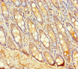 UGT2A3 Antibody