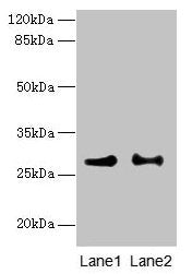 HACD2 Antibody