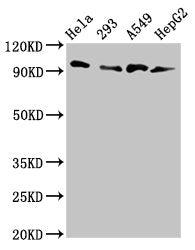 MACC1 Antibody