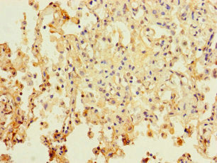 PAXIP1 Antibody
