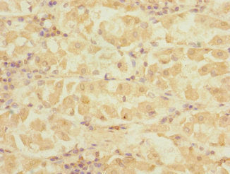 DET1 Antibody