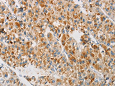 NGB Antibody