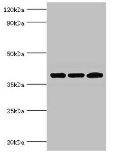 TWF2 Antibody